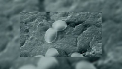 Bacillus на снимке, сделанном электронным микроскопом